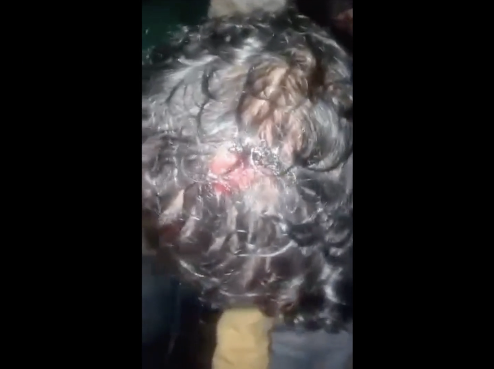 Bίαιο pushback με ξυλοδαρμό προσφύγων κοντά στη Χίο